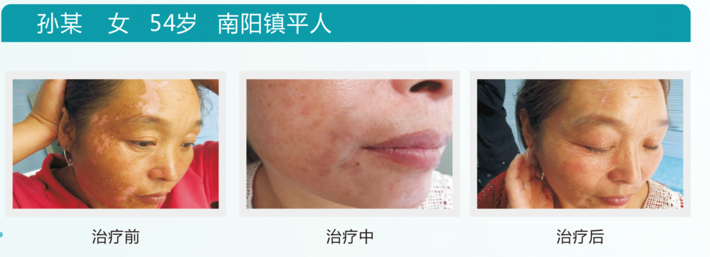 金秋送爽迎十一，白斑在南阳(图6)